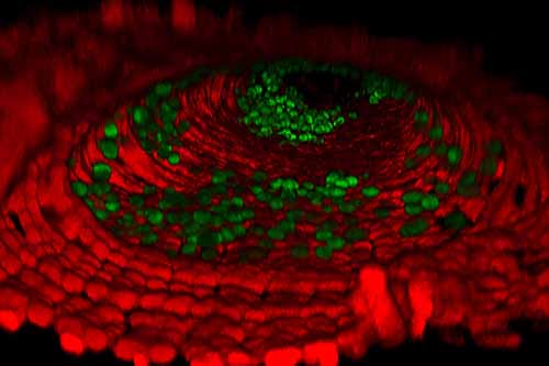Image showing intestinal tumour masses (green) growing and expanding in the intestinal cavity of a fruit fly (red). 
